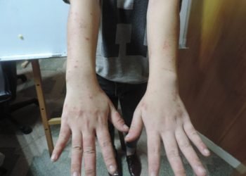 LỜI TÂM SỰ CỦA MỘT CÔ GÁI 20 TUỔI BỊ DỊ ỨNG VỚI MÔI TRƯỜNG LÀM VIỆC